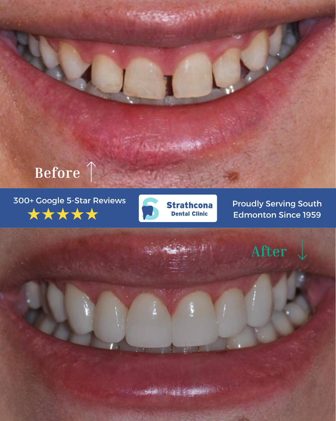 strathcona dental teeth before and after 7